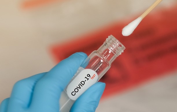 254 са новорегистрираните случаи на COVID 19 у нас през изминалото